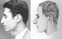 Иконотип арменида: слева – фотография, Кун; справа - рисунок, Лундман