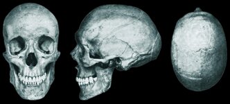 Нордический череп